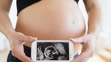 Schwangere zeigt Embryo auf ihrem Smartphone. | Bild: picture-alliance/dpa / Bildagentur-online /Tetra-Images