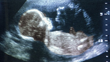 Ein Ultraschallbild eines Babys, das als erstes den Tastsinn entwickelt.  | Bild: picture-alliance/dpa/Chad Ehlers