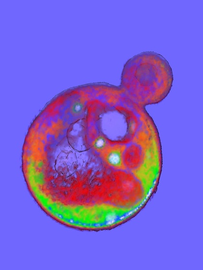 Die Bäckerhefe ist die Mikrobe des Jahres 2022. | Bild: Carolyn Larabell (2011) CIL:143, Saccharomyces cerevisiae Y12. CIL. Dataset. https://doi.org/doi:10.7295/W9CIL143