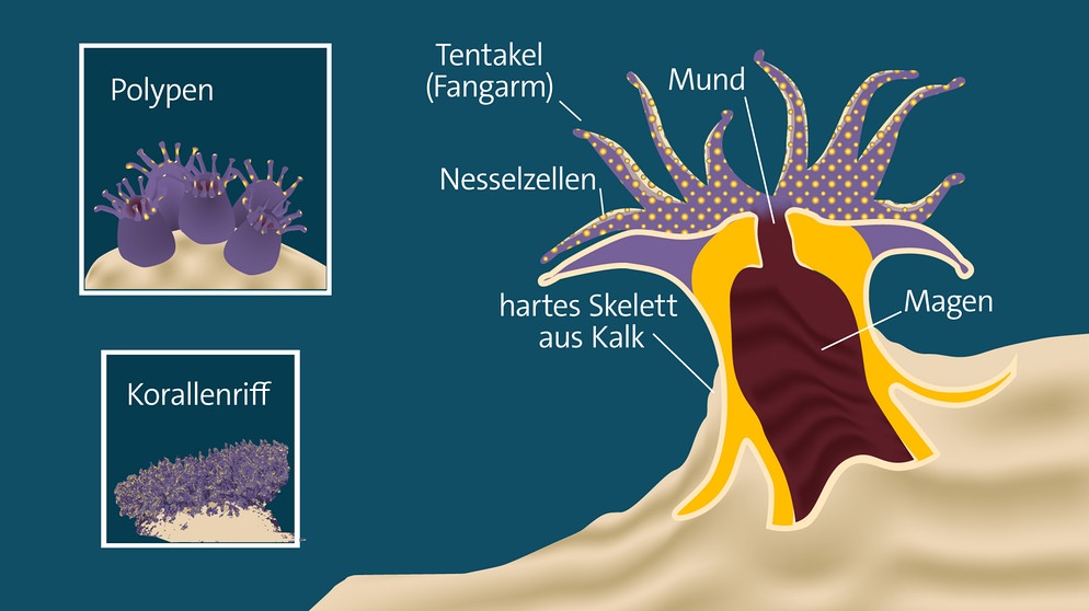 Aufbau einer Koralle: Ein Polyp besteht aus Tentakeln (Fangarmen), Nesselzellen, Mund und gleichzeitig After und Magen. Viele Polypen bilden ein Korallenriff. Die Steinkoralle bildet im Gegensatz zu den Weichkoralllen ein hartes Skelett aus Kalk. | Bild: Quelle: pa/dpa | Grafik: BR