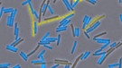 Bacillus subtilis, Mikrobe des Jahres 2023, hier im Bild tausendfach vergrößert. Das Bakterium kann unterschiedliche Lebensformen ausbilden: beweglich (blau), im Biofilm sesshaft (gelb) oder als Spore (schwarz). | Bild: Diethmaier, Stülke et al., Göttingen