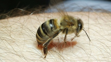 Eine Biene sticht einem Mann in den Arm | Bild: picture-alliance/dpa