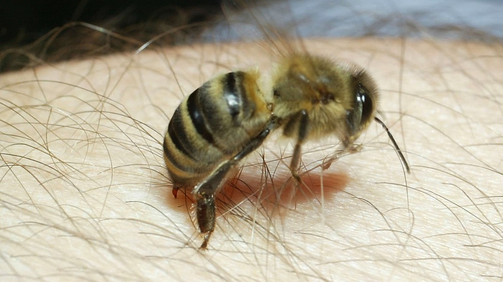 Eine Biene sticht einem Mann in den Arm | Bild: picture-alliance/dpa