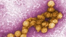 Elektronenmikroskopische Aufnahme des West-Nil-Virus | Bild: Cynthia Goldsmith/CENTERS FOR DISEASE CONTROL/EPA/dpa