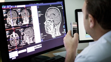 Magnetresonanztomographie, MRT Aufnahmen vom Gehirn | Bild: picture-alliance/dpa
