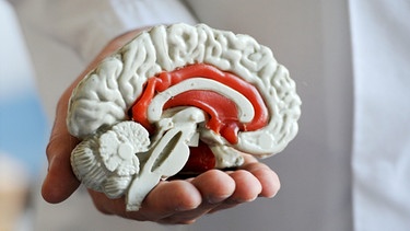 Modell des menschlichen Gehirns, Querschnitt. Wenn ihr denkt, verändert sich euer Gehirn. Die Abläufe im Hirn sind ein lebenslanger Prozess, der niemals endet.  | Bild: picture-alliance/dpa