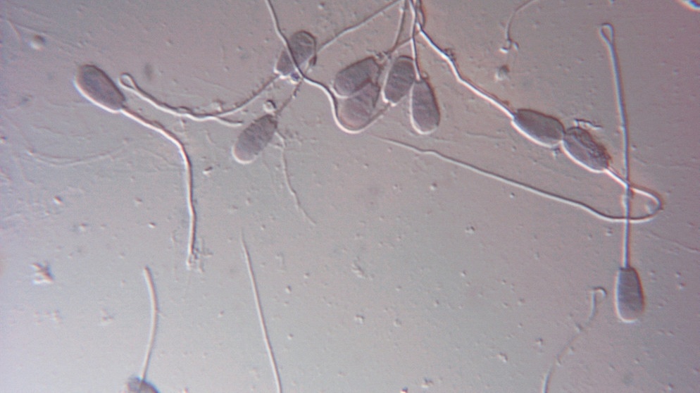 Lichtmikroskop-Aufnahme von Spermien.  | Bild: picture-alliance / OKAPIA KG, Germany | Dr. Gary Gaugler